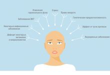 Photo of Причины и факторы риска выпадения волос