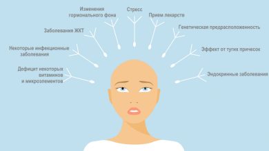 Photo of Причины выпадения волос и как их распознать