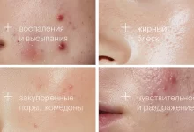 Photo of Особенности проблемной кожи и выбор косметики