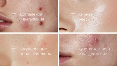 Photo of Особенности проблемной кожи и выбор косметики